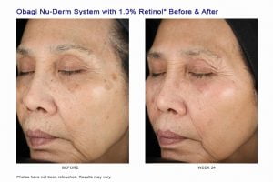 NU-DERM SYSTEM FOR NORMAL TO DRY SKIN - Dr. Raluca Harnagea - R1Aesthetic